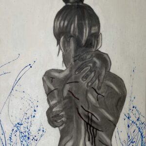 scars